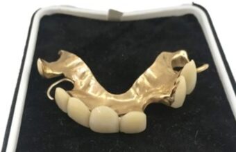 False teeth owned by Winston Churchill.